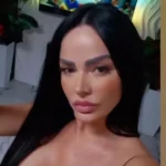 jovana utisci posle operacije